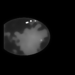 Reconstruction I